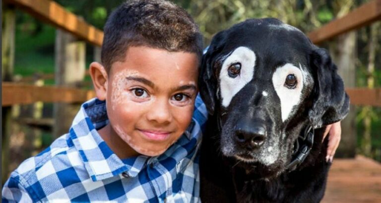 Η ιστορία του αγοριού και του σκύλου που έχουν και οι 2 λεύκη